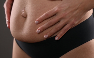 Abdominal separation in the postpartum period